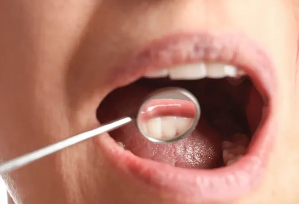 Dental Consultation